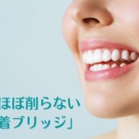 歯を削らず神経を取らないブリッジ治療｜高松市の吉本歯科医院